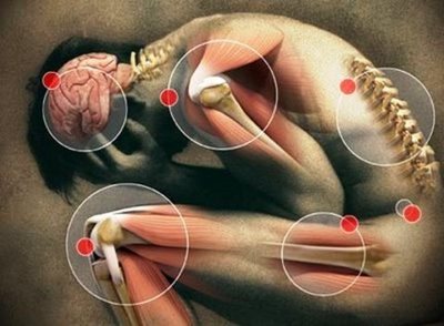 Dolor articular